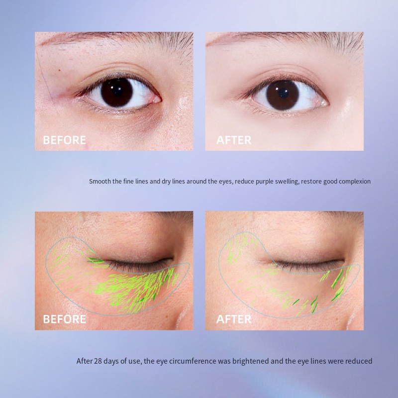 Eye Care Supplier - Eye Care Anti-Aging Eye Cream to Remove Wrinkles for Dark Circles