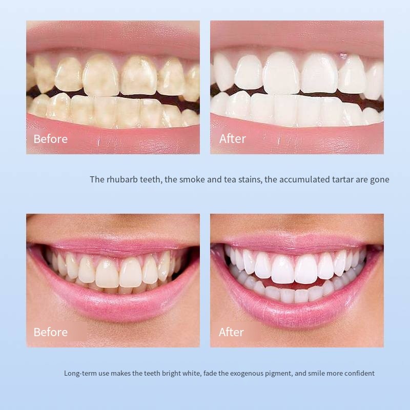 Tooth Powder Manufacturer - Wholesale OEM Tooth Powder Whitening Remove Stains Reduce Tartar Fresh Breath