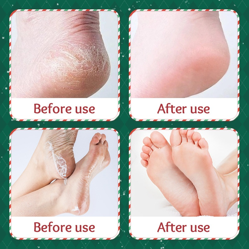 Foot Care Mask Manufacturer - SADOER Christmas Nicotinamide Foot Care Mask Exfoliating Repair Dead Skin