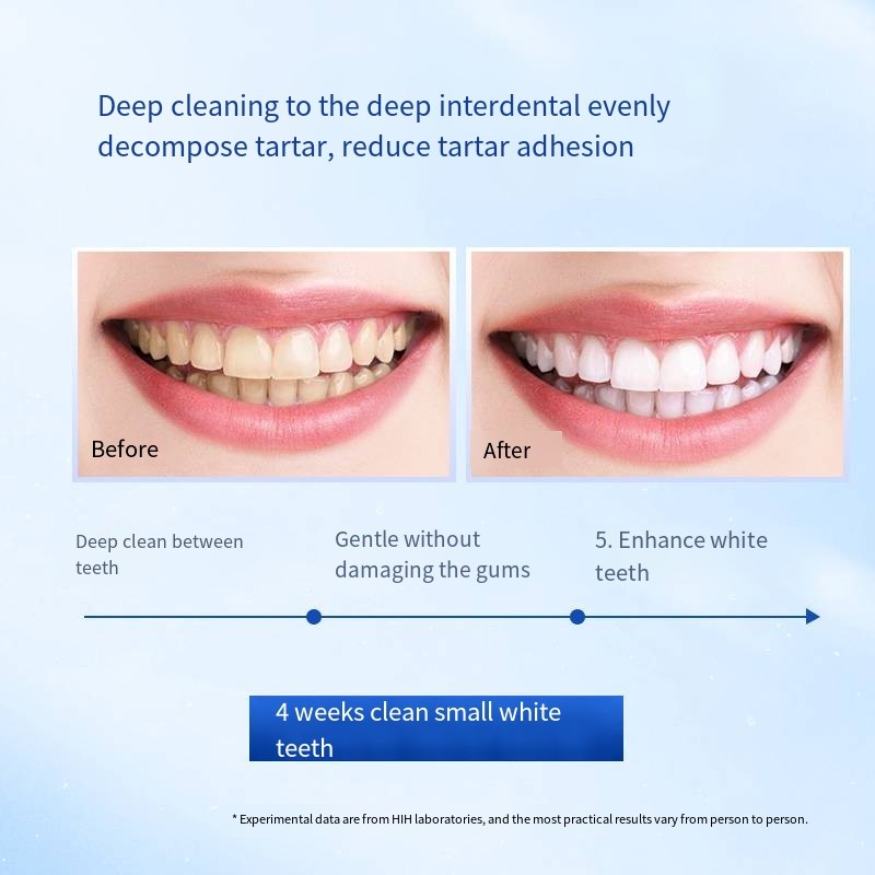 Oral Care Supplier - Wholesale OEM Tooth Whitening Remove Stains Reduce Tartar Fresh Breath Toothpaste