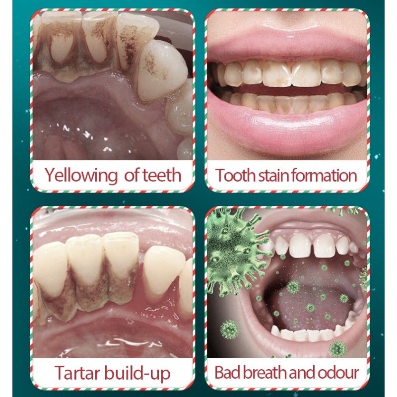 Toothpaste Supplier - OEM SADOER Christmas Natural Probiotics Sensitive Teeth Whitening Toothpaste