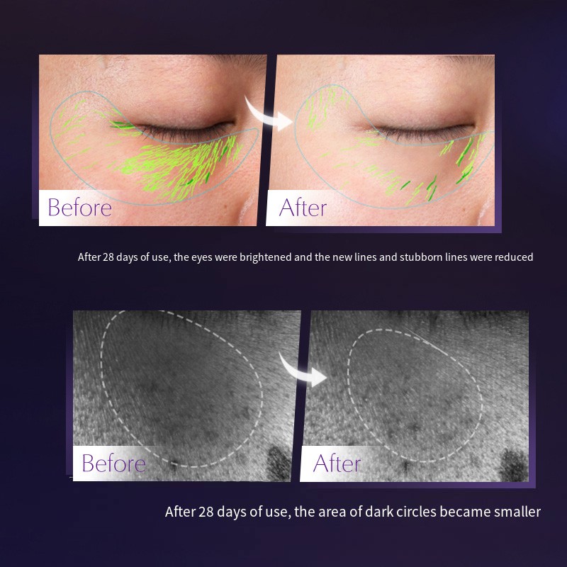 Retinol Eye Cream Factory - Private Label Vegan Retinol Eye Cream Remove Dark Circles Wrinkle