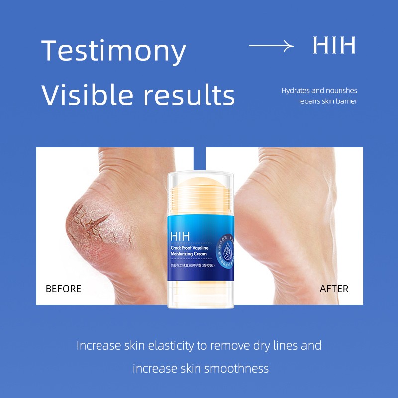 Foot Cream Manufacturer - Wholesale Shea Butter Vitamin E Foot Cream Heeling Cracked Hand Care Salve