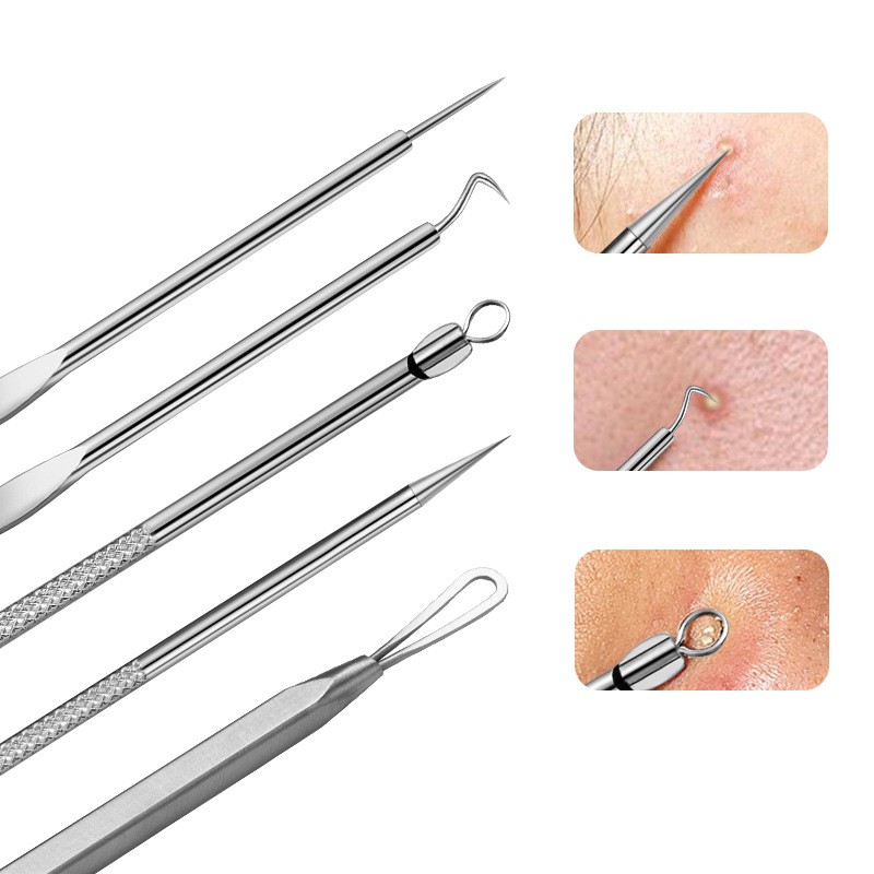 Pimple Remover Tool Factory - Factory Hot Sale Stainless Steel Pimple Remover Blackhead Pin Blackhead Remover Tool