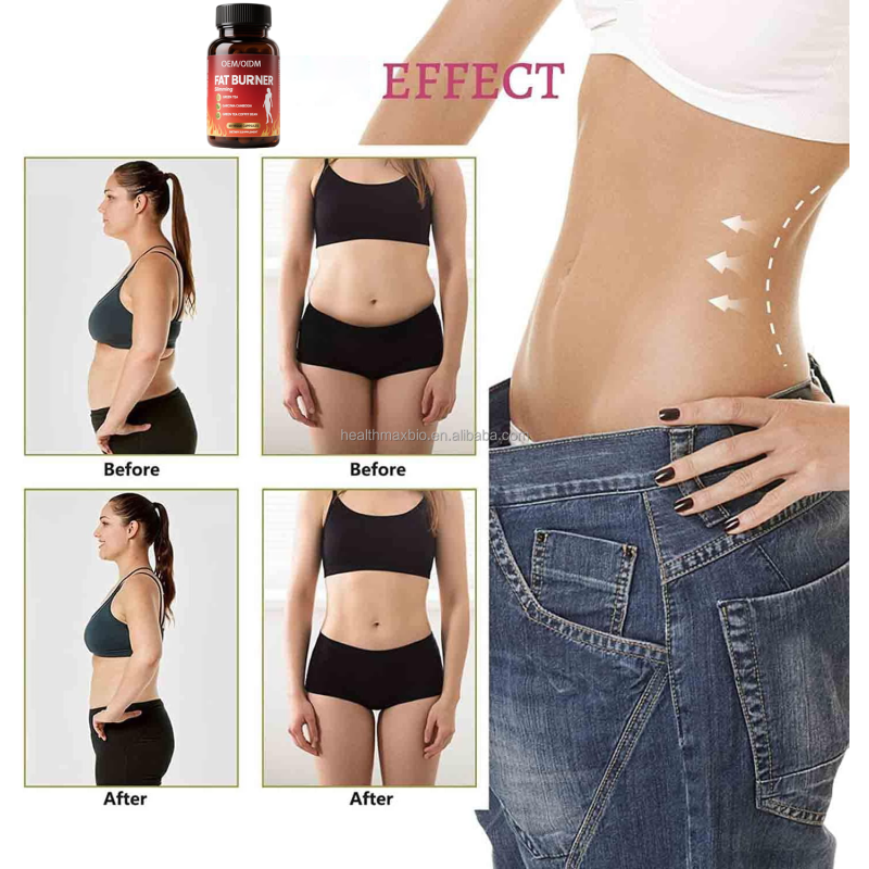 Slimming Capsules Factory - OEM Private Label Herbal Diet Pills Fast Acting