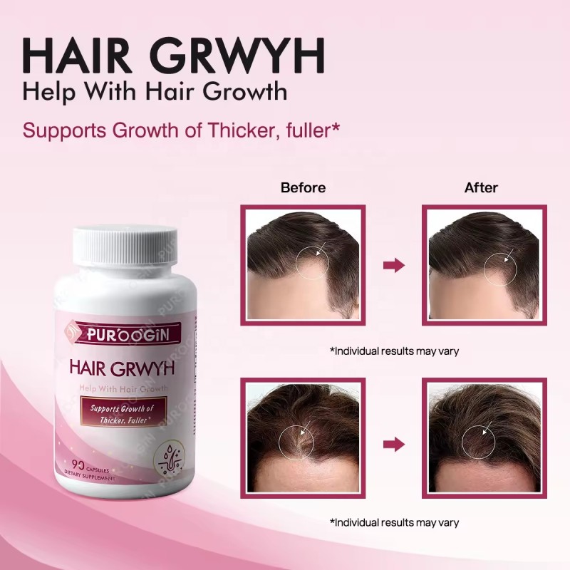 Hair Growth Capsules Manufacturer - OEM Custom B-Complex Biotin