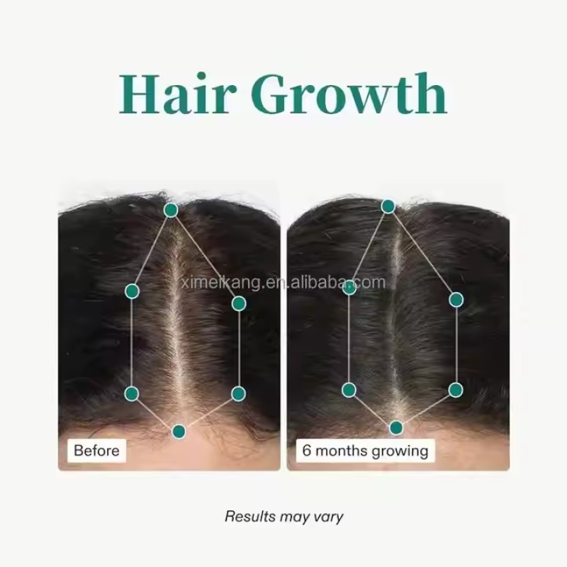 Hair Growth Tablets Manufacturer - OEM/ODM Nutritional Formula for Existing Hair Growth