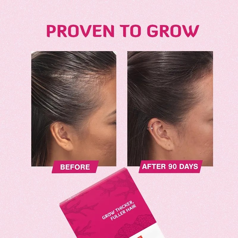Adult Hair Growth Tablets Manufacturer - Best Selling Reduces Hair Loss Support
