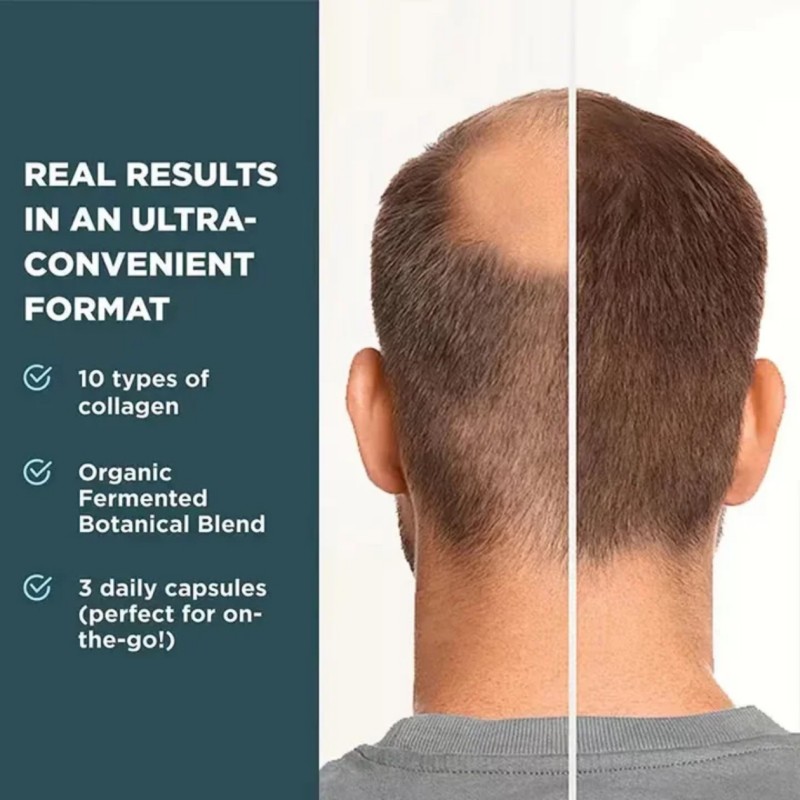 Hair Growth Tablets Factory - OEM/ODM Nutritional Formula for Healthy Hair