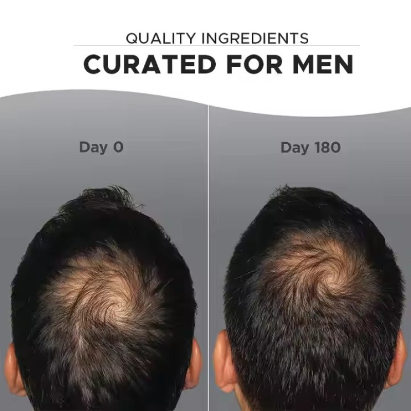 Male Hair Growth Tablets Factory - Best Selling Supplements for Sparse Hair Nourishment