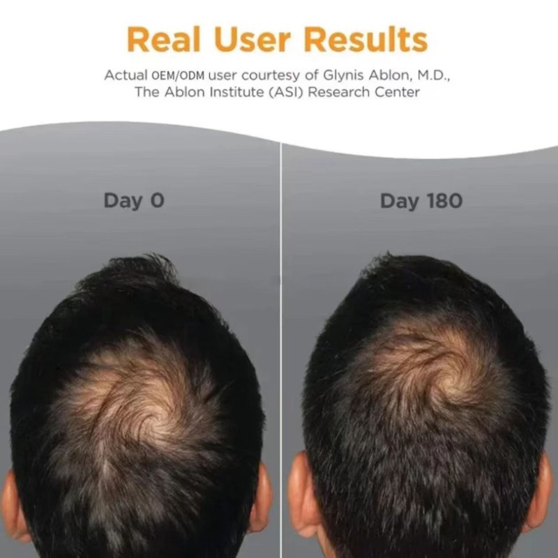 Hair Growth Supplement Tablets Factory - Supply 180 Tablets with Collagen Complex