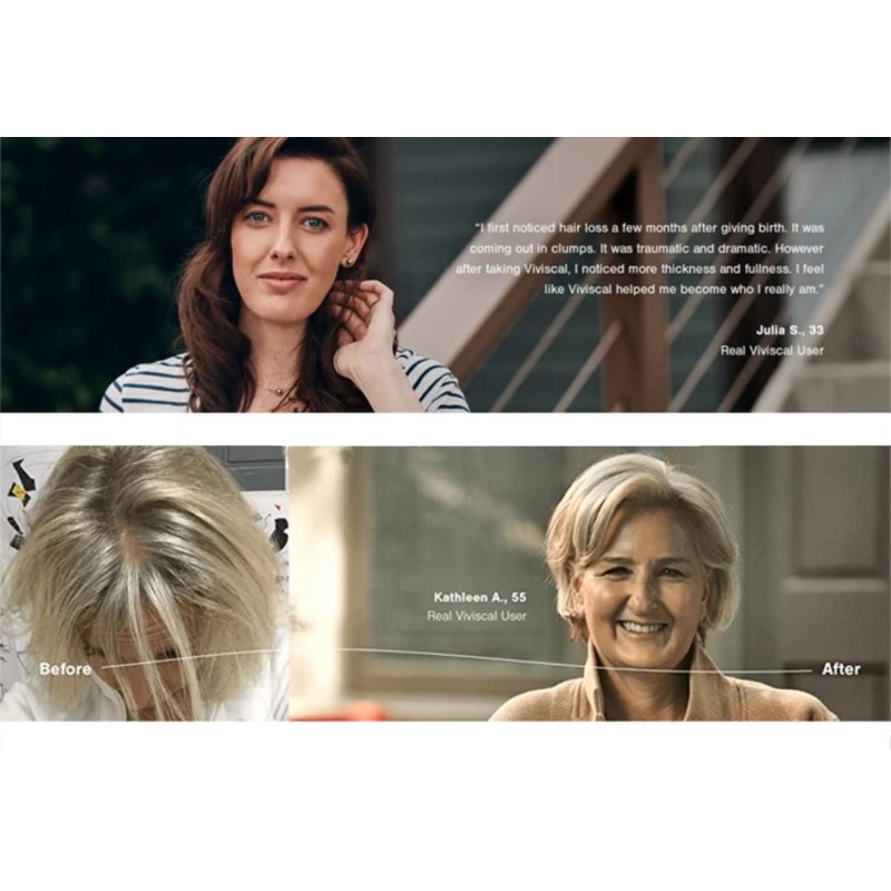 Adult Hair Growth Tablets Supplier - Factory Best Selling Scientific Formula