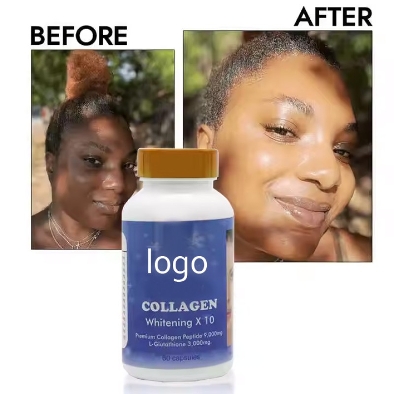 Collagen Soft Capsule Factory - Private Label Glutathione Vitamin C