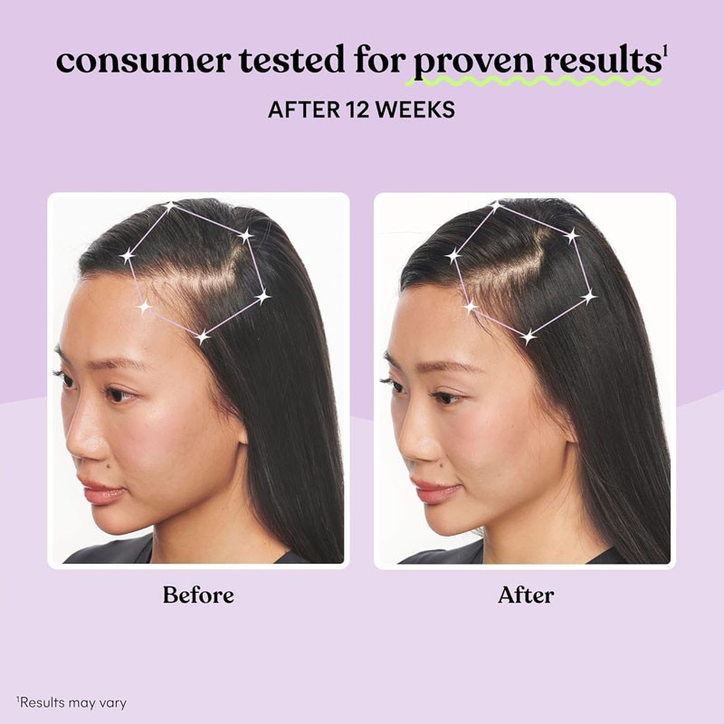 Hair Growth Supplement Manufacturer - OEM ODM Thinning Hair Capsules