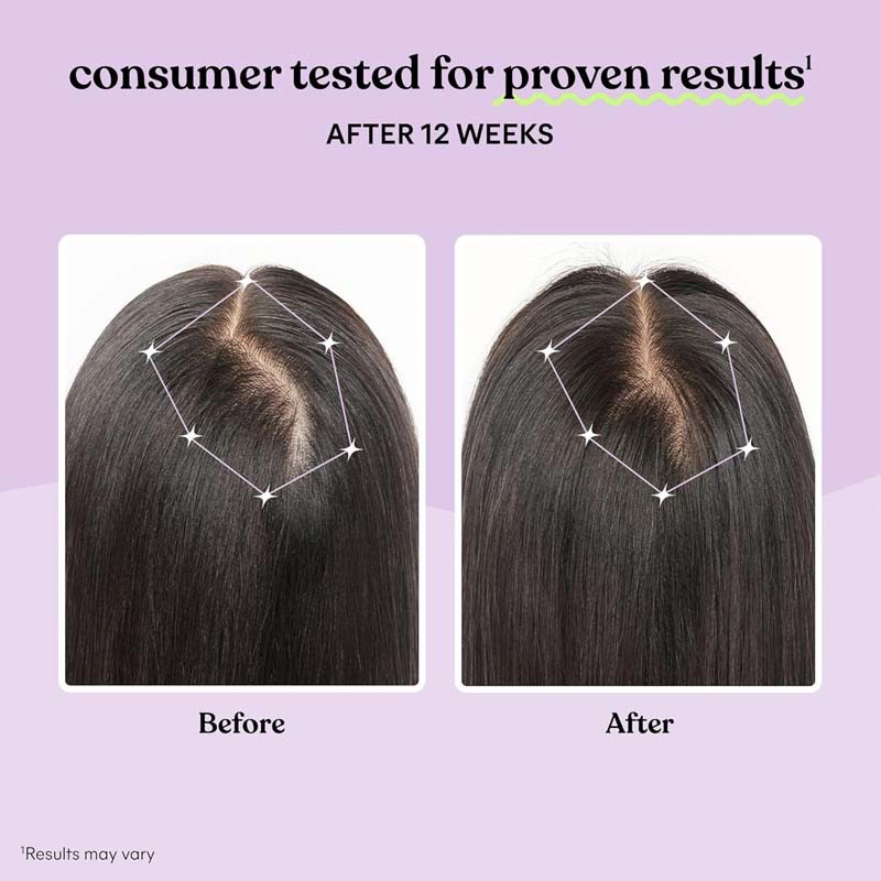 Hair Growth Supplement Manufacturer - OEM ODM Thinning Hair Capsules