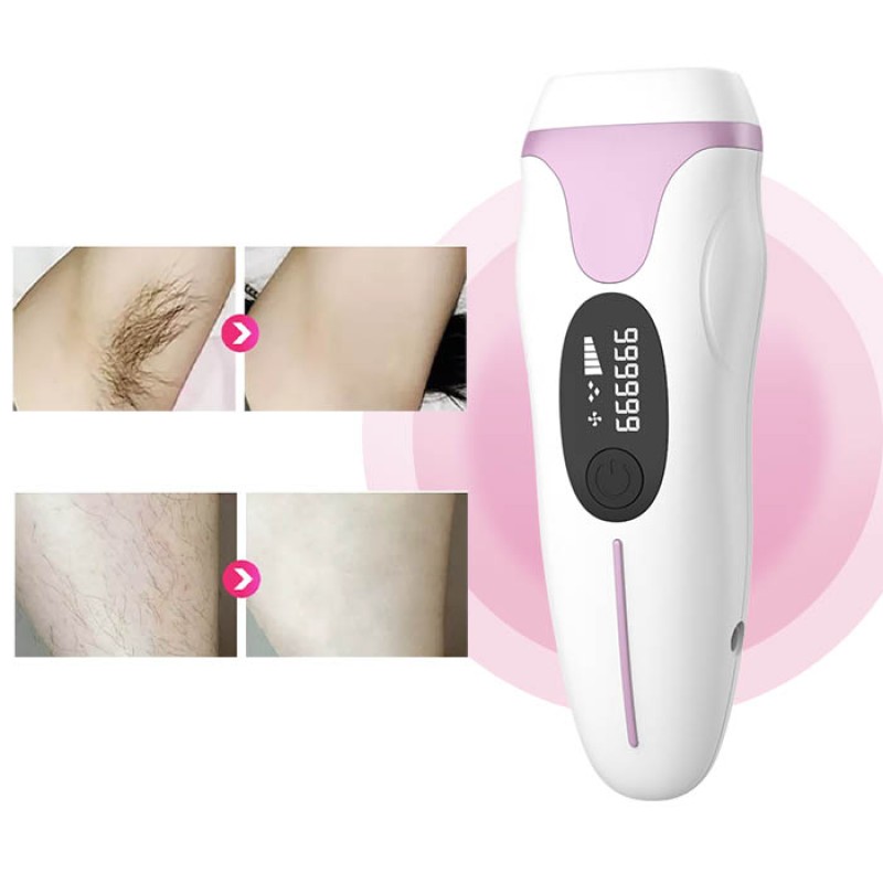 Dropshipping AMAZON  IPL Hair Removal Machine Laser Home Use 999,999 Flashes  Permanent Hair Removal Device Hot Sale in Japan