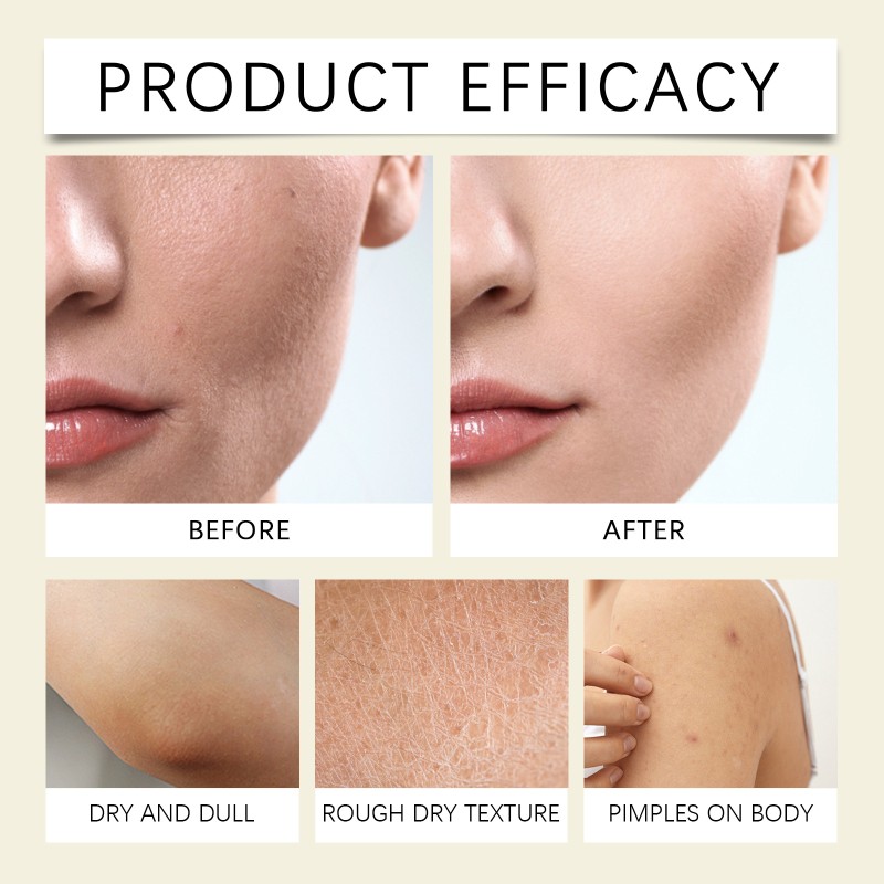 Skin Cream Manufacturer - Butter Nourishing Daily Moisturizer