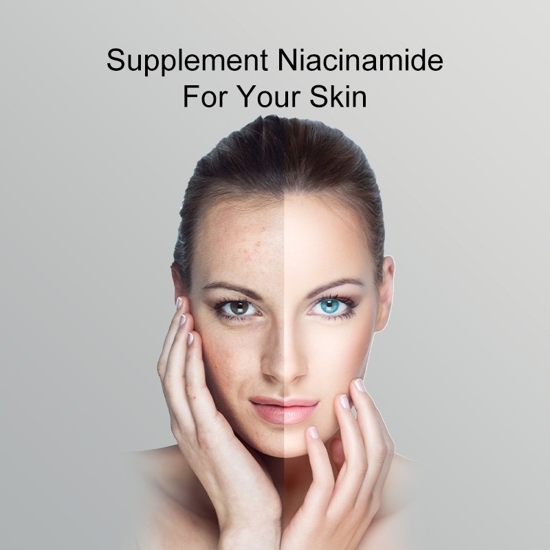 Amazon Hot 1800 mg Nicotinamide Capsules Gluten-Free Premium Beauty Product for Women Pills Dosage Vitamin for Brightening Skin