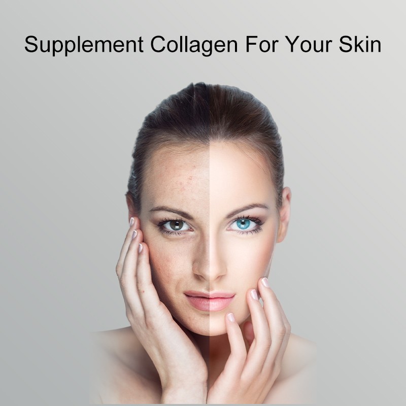 Hot Selling Collagen Women's Beauty Products Gluten-free High Quality Collagen Own Brand 1200mg