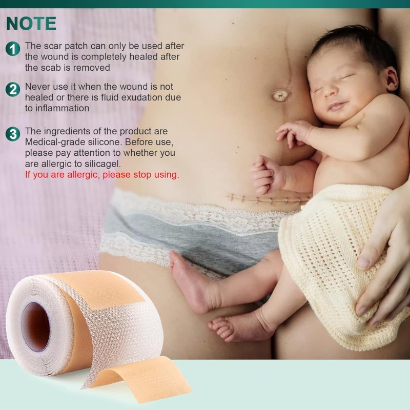 OEM/ODM Silicone Scar Sheets Silicone Scar Tape Reusable and Effective Scar Removal Sheets