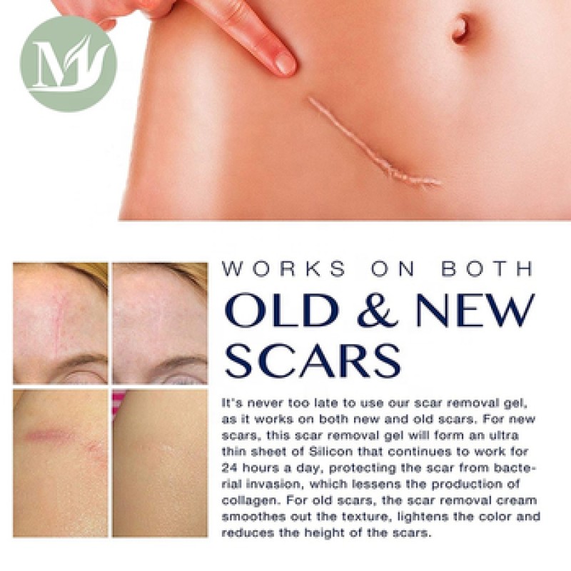 Private Label Acne Scar Removal Gel Skin Treatment Cream Sheet Best Effect Medical-Grade Silicone Scar Gel for Scar Away