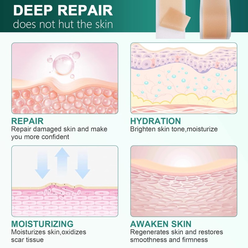 OEM/ODM Silicone Scar Sheets Silicone Scar Tape Reusable and Effective Scar Removal Sheets