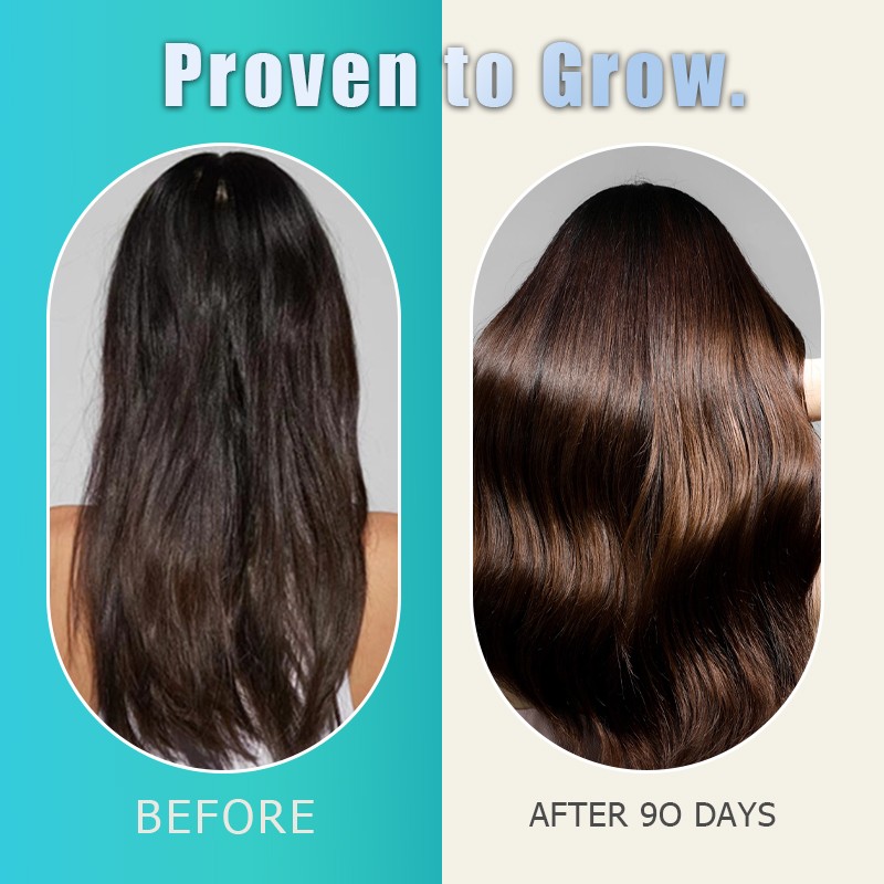 Manufacture Hair Growth Supplement Fast Nourishing Biotin Pills Tablets Improve Promote Hair Thickness Reduce Shedding Dietary
