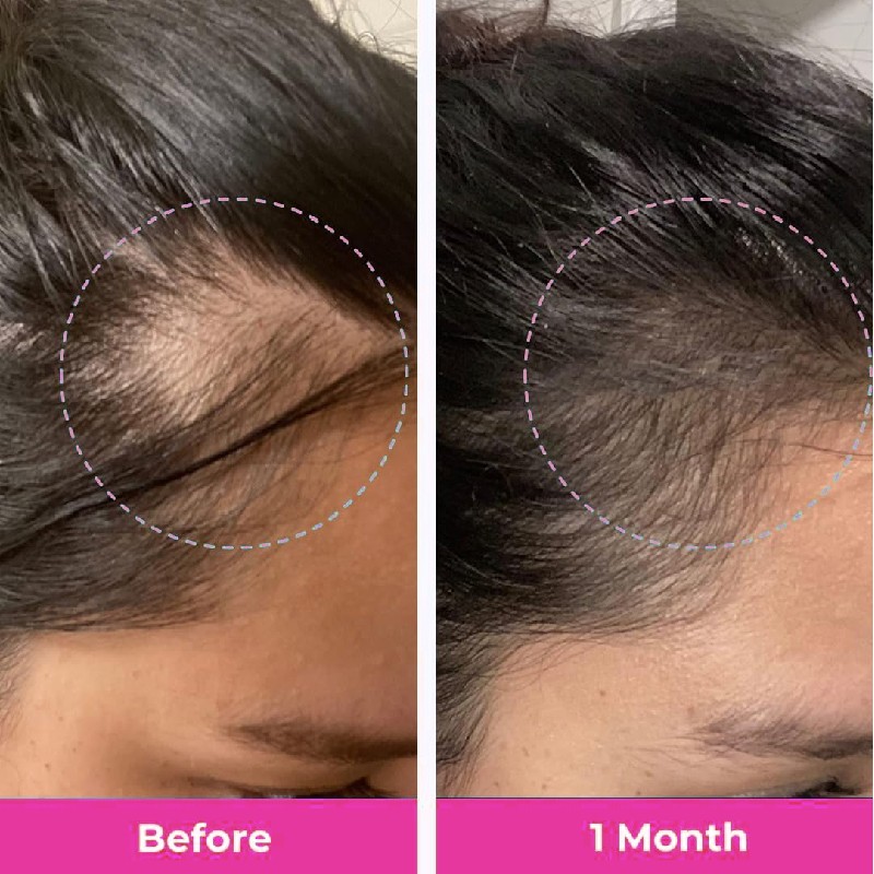 OEM Private Label Vegan Biotin Gummies Hair Vitamin Gummies Supplement Biotin Collage Keratin Gummies with Collagen Vitamin C