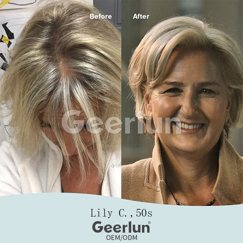 Hair Growth Tablets Manufacturer - Advanced Vitamin Biotin