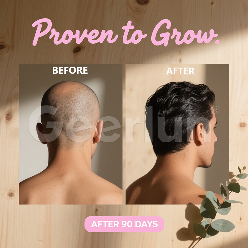 Biotin Oral Films Manufacturer - Hair Growth Dissolving Strips