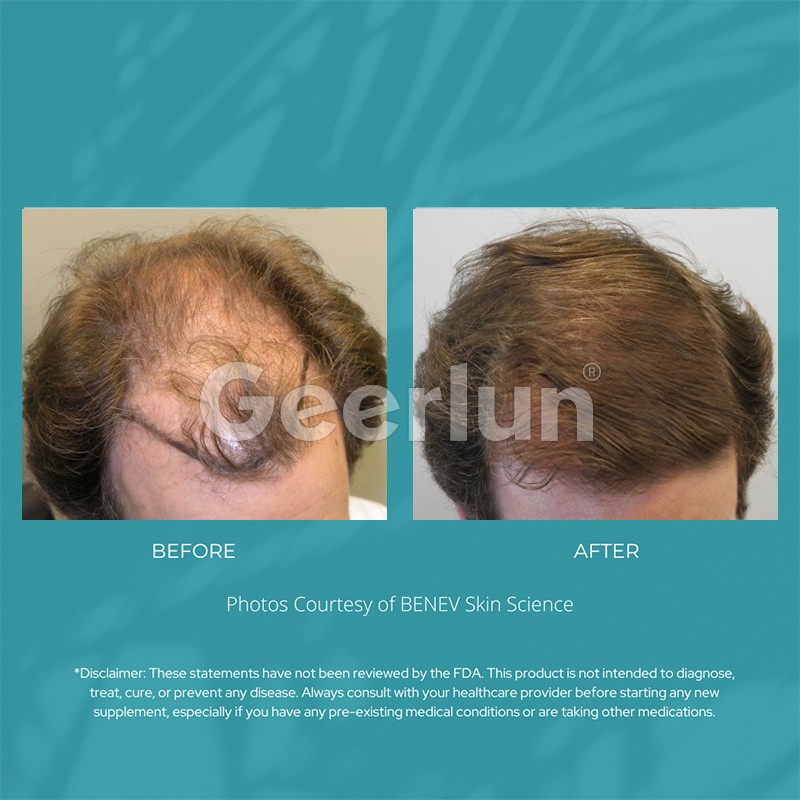 Hair Growth Tablets Manufacturer - Advanced Vitamin Biotin