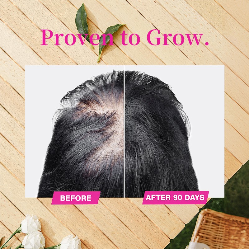 Hair Growth Tablets Factory - Advanced Biotin Women