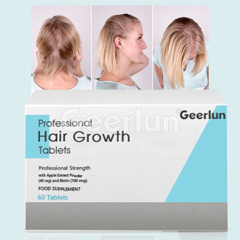 Hair Growth Tablets Factory - Professional Regrowth Longer