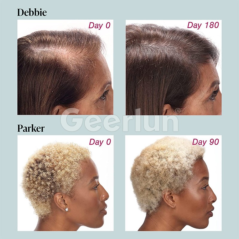Hair Growth Tablets Manufacturer - Hot Selling Biotin Custom