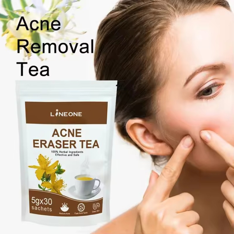 Acne Tea Bag Manufacturer - Private Label Herbal Detox Tea