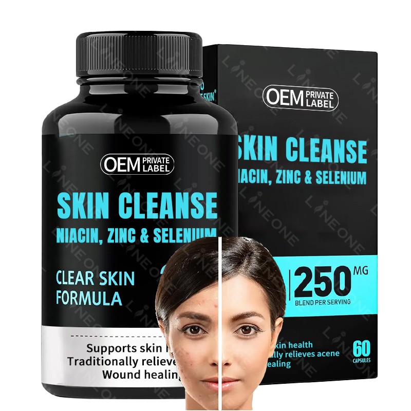 Acne Supplement Factory - Skin Care Anti Acne Capsules OEM