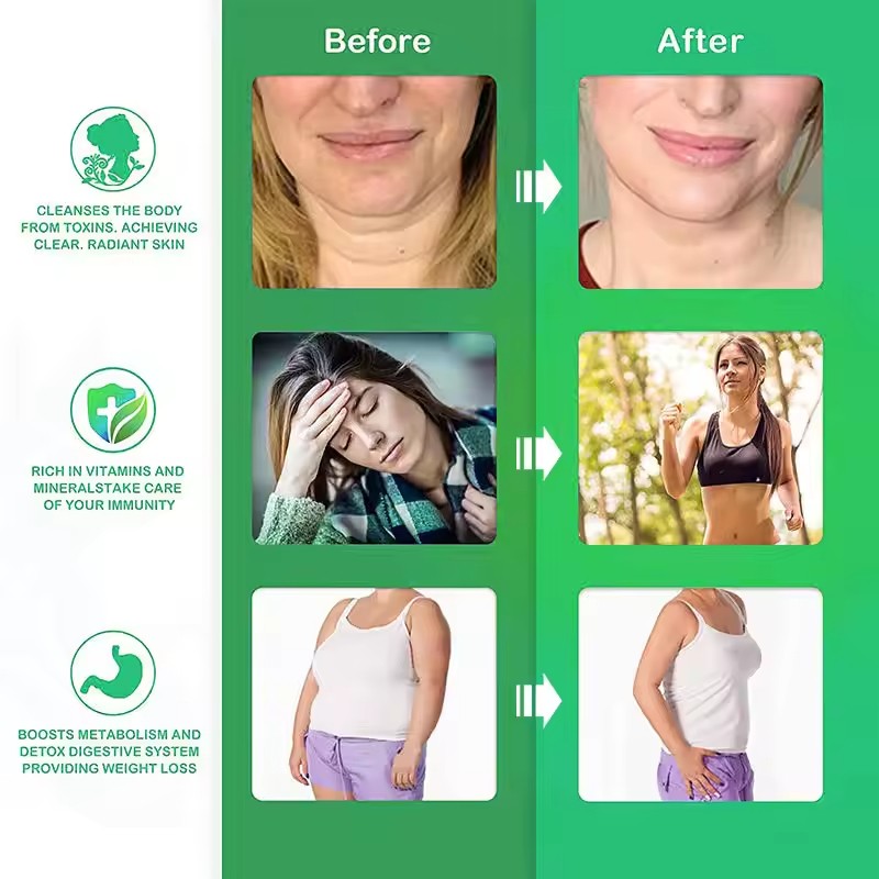 Sea Moss Gummies Supplier - OEM Apple Cider Vinegar Gummies