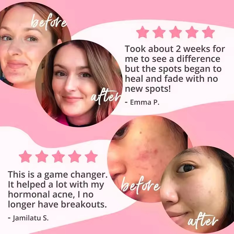 Collagen Capsules Supplier - OEM Biotin Keratin Hyaluronic Acid