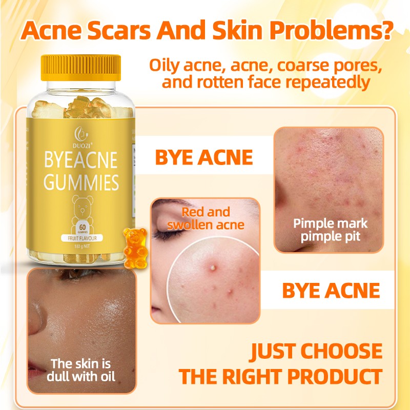 Acne Gummies Factory - Herbal Supplements Redness Elimination