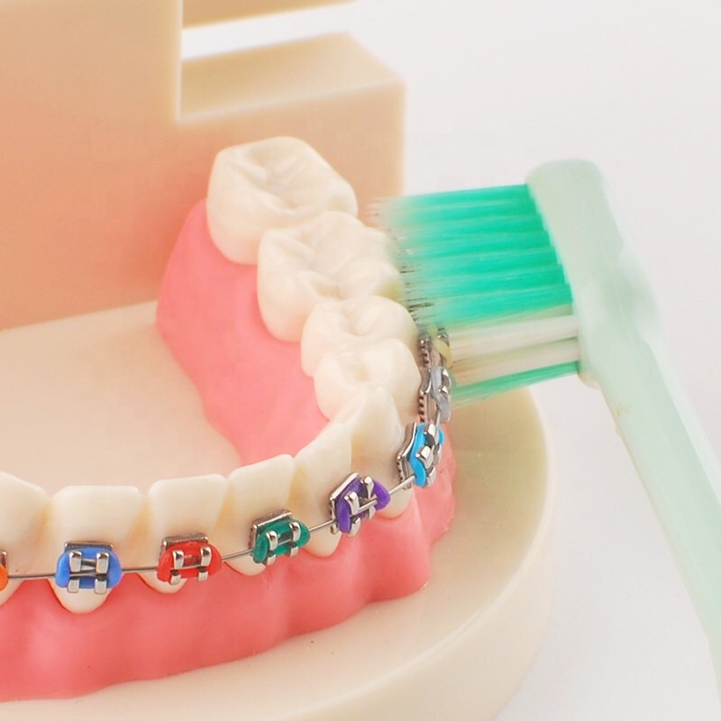 Orthodontic Toothbrush Factory - Custom Logo Soft U-trim