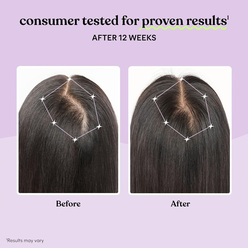 Hair Growth Capsules Supplier - OEM Keratin Scalp Coverage