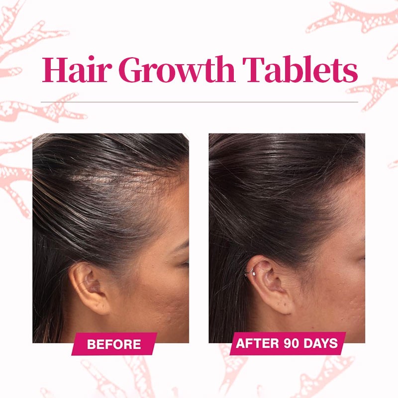 Hair Growth Tablets Supplier - Private Label Thicker Collagen