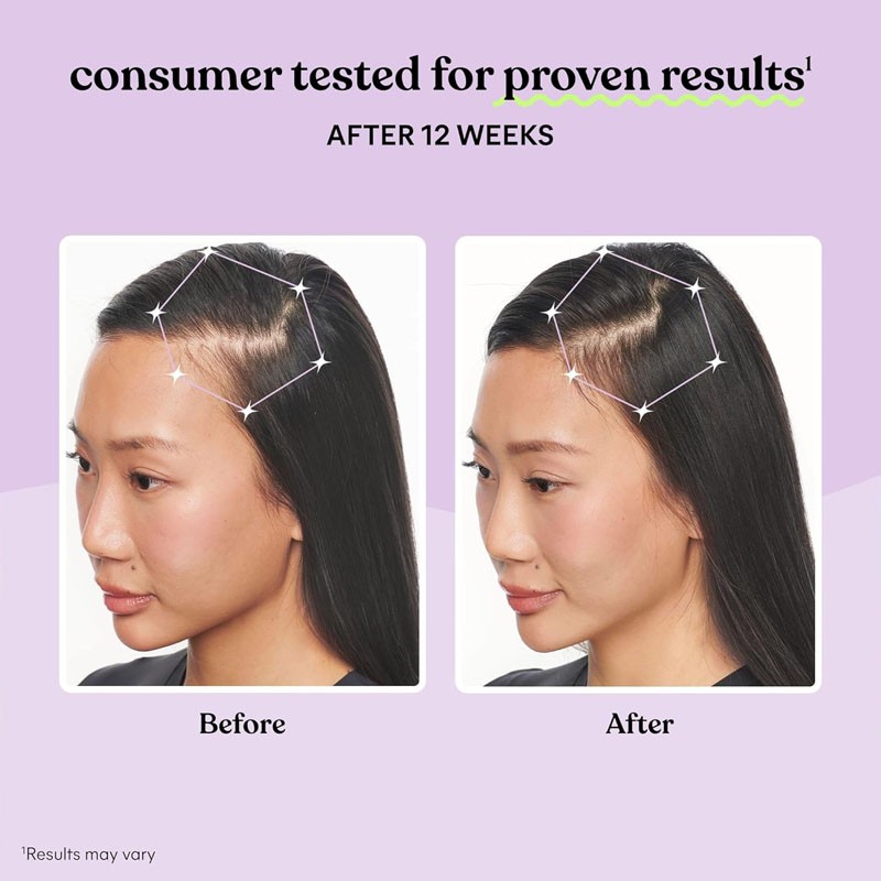 Hair Growth Capsules Supplier - OEM Keratin Scalp Coverage