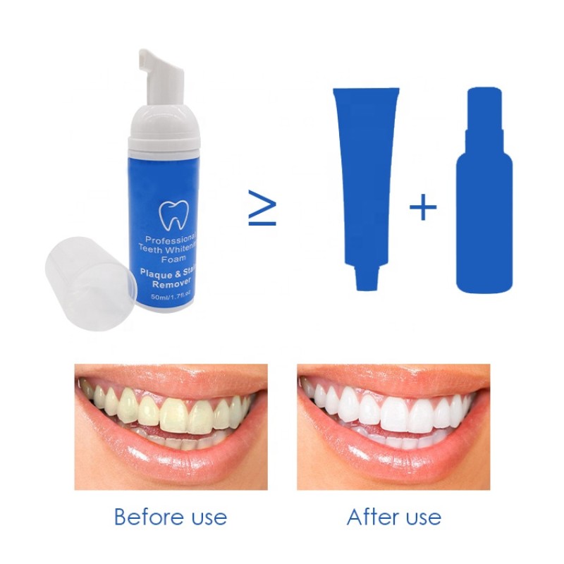 Brace Cleaner Supplier - Strong Effect 360 Deep Cleansing