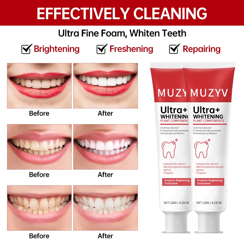 Probiotics Toothpaste Manufacturer - OEM Herbal Gum Care