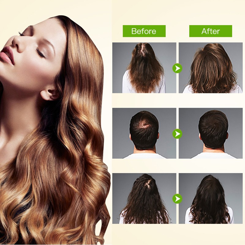 Castor Oil Factory - Private Label Wholesales Pure Organic