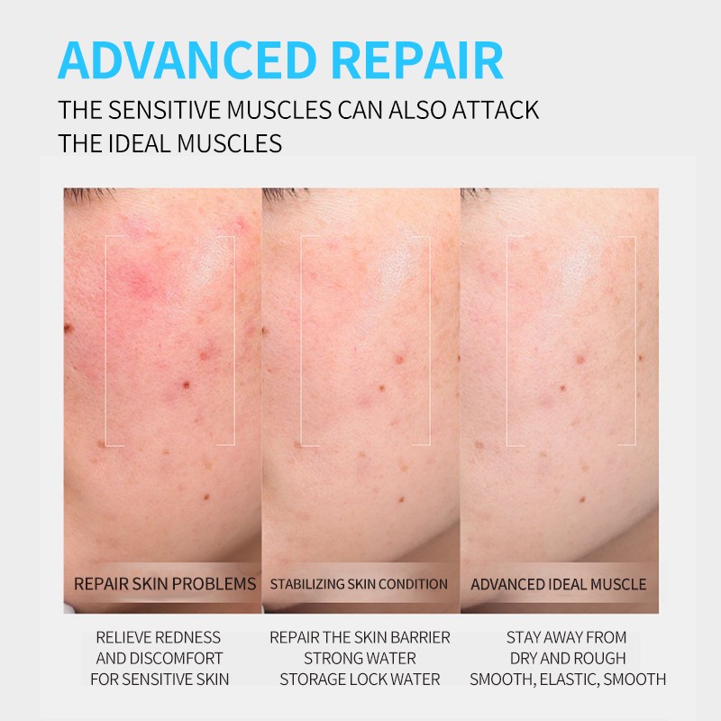 Vitamin C Serum Factory - Alpha Arbutin Glutathione Stem Cell