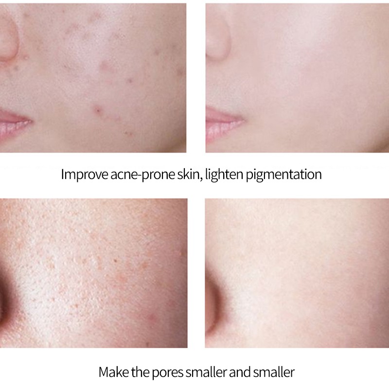 Microneedle Serum Supplier - Private Label Egf Lyophilized Powder