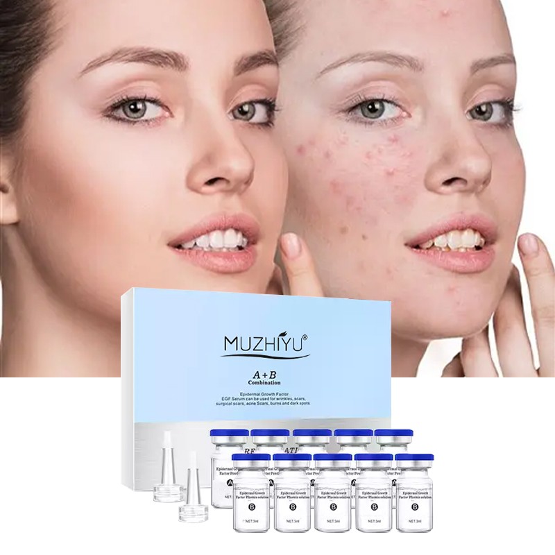 Microneedle Serum Supplier - Private Label Egf Lyophilized Powder