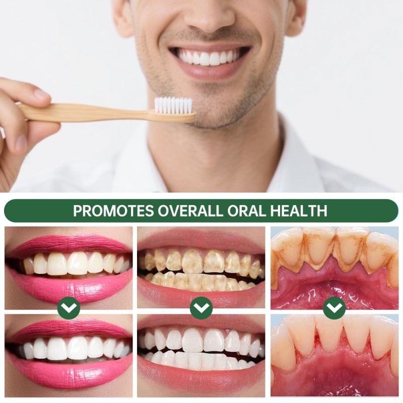 Toothpaste Tablets Factory - OEM Anticavity Mint Travel